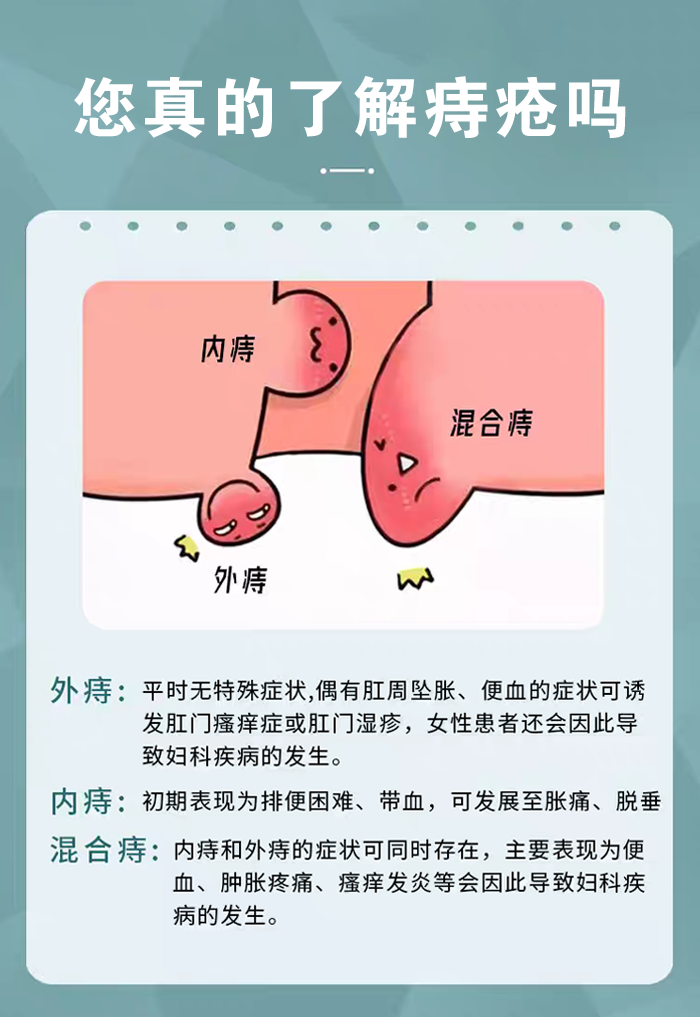 痔疮胶囊_03.png